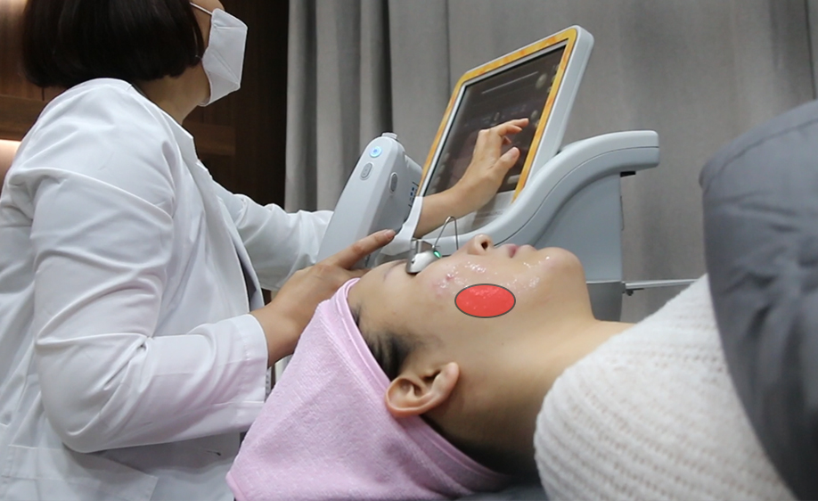 볼패임이 나타날 가능성이 높은 부위