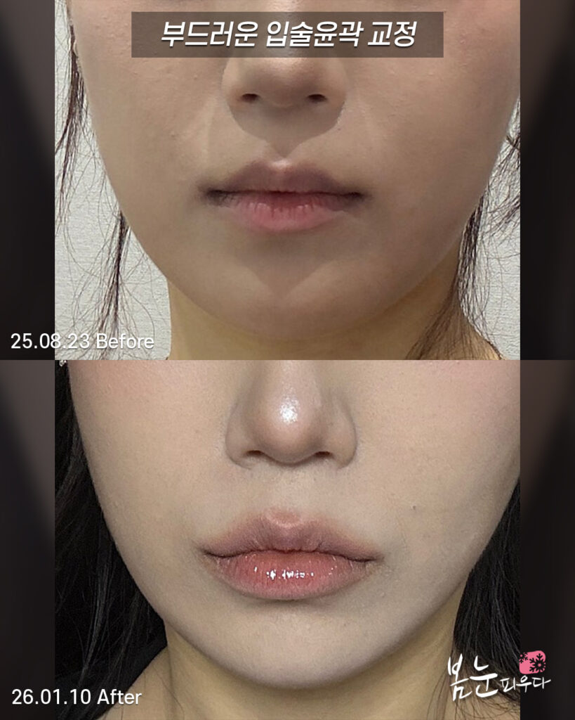 얼굴 이미지를 바꿔주는 입술디자인